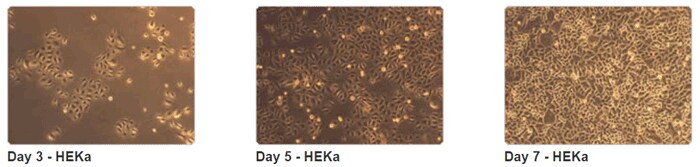 在 EpiLife 培养基中培养的 HEKa 细胞 在 EpiLife 培养基中培养的 HEKa 细胞