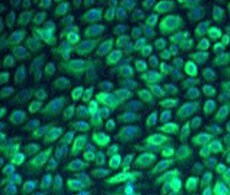 Mammary-Epithelial-Cell-Culture-Systems 乳腺上皮细胞培养系统