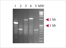 Amplification Long Transcript Amplification Long Transcript