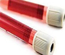 GeneCatcher Magnetic Beads two red vials