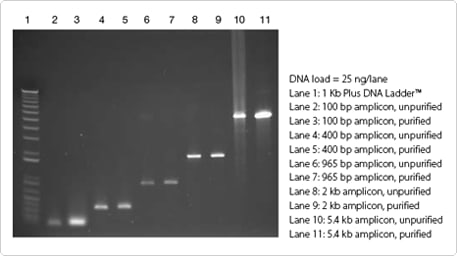 data.par.27463.image.457.259.1.dat-agarose-extraction-jpg data.par.27463.image.457.259.1.dat-agarose-extraction-jpg