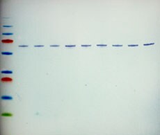 Colorimetric western blot visualized with Invitrogen Dual LED Blue White Light Transilluminator Colorimetric western blot visualized with Invitrogen Dual LED Blue White Light Transilluminator