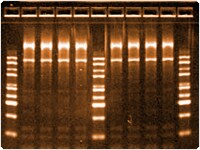 RNA 电泳 RNA 电泳