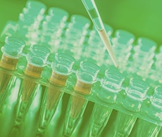 根据 RNA 类型提取 RNA RNA 提取(根据 RNA 类型)