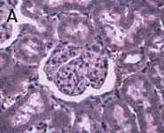 dat-fig1a 激光捕获显微切割