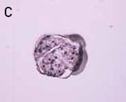 激光捕获显微切割 激光捕获显微切割