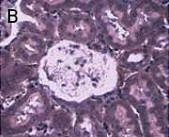 dat-fig1b 激光捕获显微切割