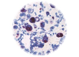 FFPE Tissue sample FFPE Tissue sample