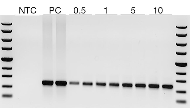 Amplification of DNA extracted from FFPE tissue samples Amplification of DNA extracted from FFPE tissue samples