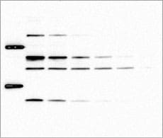 Chemiluminescent Western Blot Detection Chemiluminescent Western Blot Detection