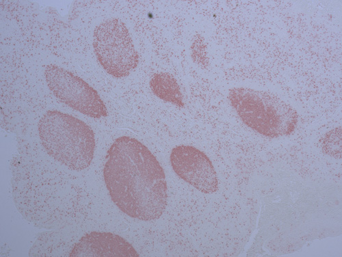 FFPE with SuperBoost EverRed human tonsil stained with Ki-67 antibody/superboost everred