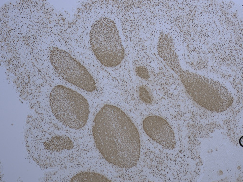 FFPE with DAB human tonsil stained with Ki-67 antibody/DAB
