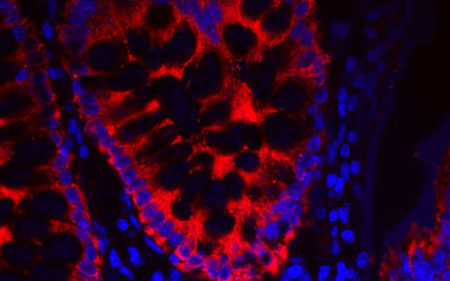 Cytokeratin-DyLight-streptavidin-450px Cytokeratin-DyLight-streptavidin-450px