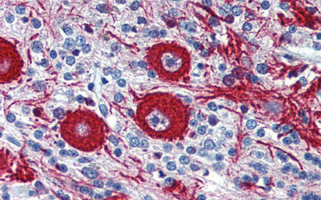 chromogenic-IHC-450px chromogenic-IHC-450px