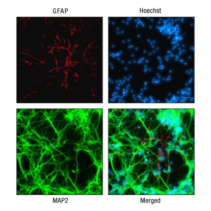 A14n06-Fig4d A14n06-Fig4d