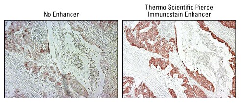 Improve specificity and signal intensity and reduce background in chromogenic immunohistochemistry Improve specificity and signal intensity and reduce background in chromogenic immunohistochemistry