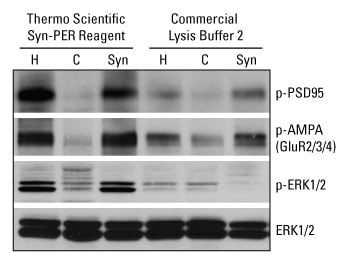A12n03-Fig6-87793-Syn-PER A12n03-Fig6-87793-Syn-PER