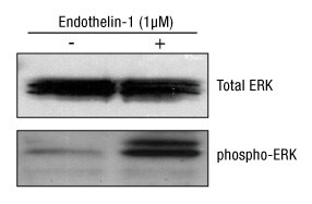 A14n09-Fig6B A14n09-Fig6B