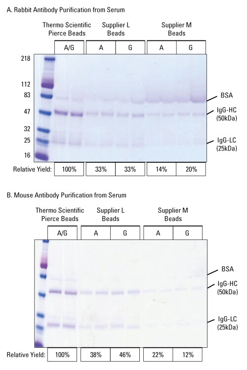 88802-ProteinAGMag-002-stacked 88802-ProteinAGMag-002-stacked