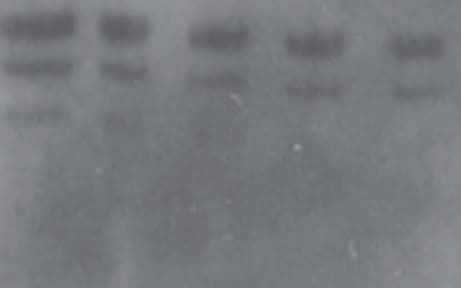 WB常见问题—高背景 WB常见问题—高背景