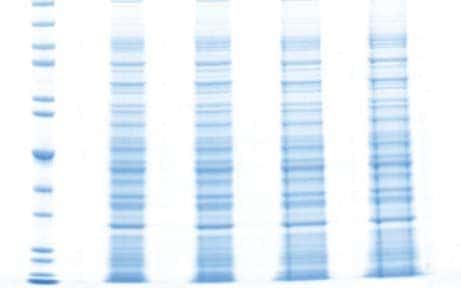 电泳常见问题-样品过粘,样品泳道边缘有纵向条纹,哑铃型条带,泳道变宽 电泳常见问题-样品过粘,样品泳道边缘有纵向条纹,哑铃型条带,泳道变宽