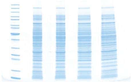 蛋白质电泳常见问题--泳道变宽,宽度不一致 蛋白质电泳常见问题--泳道变宽,宽度不一致