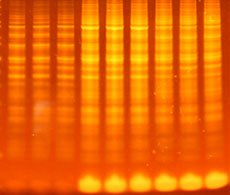 SYPRO Ruby stained Protein gel SYPRO Ruby stained Protein gel