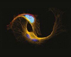 Apoptosis apoptotic cells with green caspase-3, orange tubulin, blue nuclei, and light blue overlay of caspase, nuclei, and magenta TUNEL