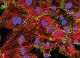 5步心脏病建模 5步心脏病建模