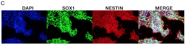 四组系列图片展示了DAPI染色(蓝色)、SOX1表达(红色),巢蛋白表达(绿色)以及三张图片的叠加组合。 四组系列图片展示了DAPI染色(蓝色)、SOX1表达(红色),巢蛋白表达(绿色)以及三张图片的叠加组合。