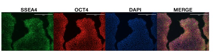 四组系列图片展示了 iPSC 不同染色的结果,SSEA4 表达(绿色),OCT4 表达(红色),DAPI 染色(蓝色)以及三张图片的重叠组合。 四组系列图片展示了 iPSC 不同染色的结果,SSEA4 表达(绿色),OCT4 表达(红色),DAPI 染色(蓝色)以及三张图片的重叠组合。