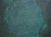 Large colony of H9 human ESCs stained green with TRA-1-60 and counterstained blue with DAPI nuclear stain. Surrounded by non-stained black MEFs. Large colony of H9 human ESCs stained green with TRA-1-60 and counterstained blue with DAPI nuclear stain. Surrounded by non-stained black MEFs.