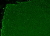 Large colony of H9 human ESCs stained green with SSEA4 primary antibody and an AlexaFluor 488-conjugated anti-mouse lgG secondary antibody. Large colony of H9 human ESCs stained green with SSEA4 primary antibody and an AlexaFluor 488-conjugated anti-mouse lgG secondary antibody.