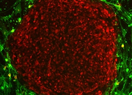 培养中 PSC 集落的显微观察 培养中 PSC 集落的显微观察