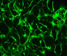 神经干细胞(NSCs) 神经干细胞(NSCs)