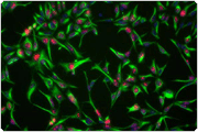 showcase.par.31291.image.0.0.1 human neural stem cells