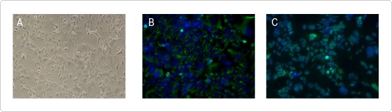hNSC 在 CELLstart 包被培养皿中生长 hNSC 在添加了无血清培养基的 CELLstart 底物包被培养皿中生长,表现出正常形态并表达 hNSC 标志物