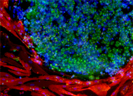 Stem Cell Reprogramming Tools Stem Cell Reprogramming Tools