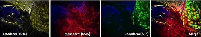 EB 的细胞分析 EB 的细胞分析