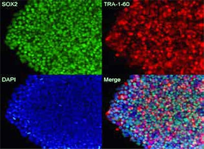固定的造血干细胞细胞内标记物分析 固定的造血干细胞细胞内标记物分析