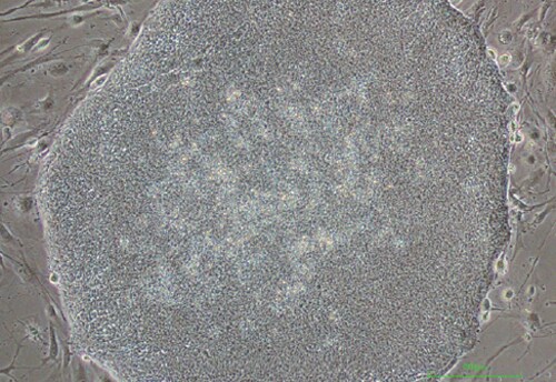 在灭活 MEF 上生长的 H9 hESC 的相差图像 在灭活 MEF 上生长的 H9 hESC 的相差图像