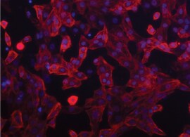 Fluorescently stained cells microscopic view of fluorescence-stained cells in culture