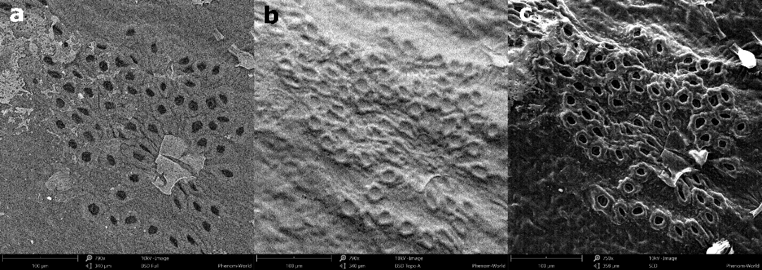 a) Full BSD, b) topography BSD, and c) SED image of a leaf. a) Full BSD, b) topography BSD, and c) SED image of a leaf.
