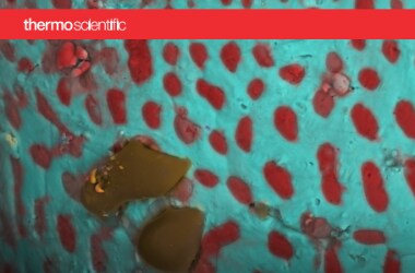 brochure-scanning-electron-eicroscopes-380x250 brochure-scanning-electron-eicroscopes-380x250