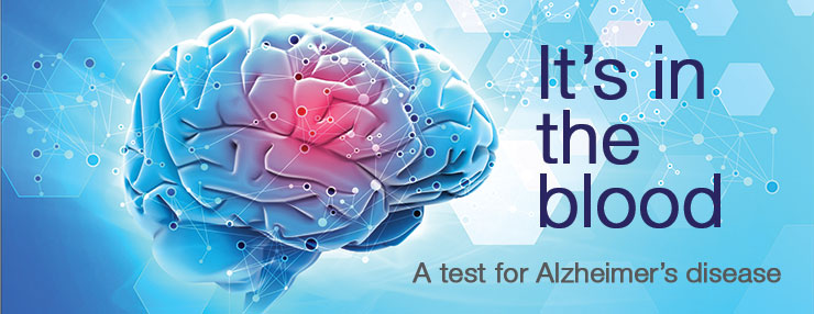 Detecting Alzheimer’s Disease Biomarkers Detecting Alzheimer’s Disease Biomarkers