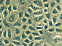 上皮细胞培养物 上皮细胞培养物