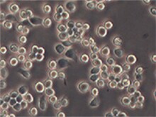 淋巴母细胞培养物 淋巴母细胞培养物