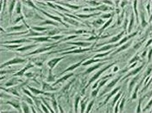 成纤维细胞培养物 成纤维细胞培养物