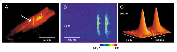 chelators-calibration-buffers.par.37955.image.725.214.1.s001756-guinea-pig-ventricular-myocyte-gif chelators-calibration-buffers.par.37955.image.725.214.1.s001756-guinea-pig-ventricular-myocyte-gif