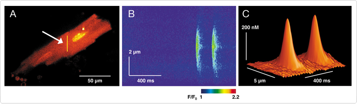 chelators-calibration-buffers.par.37955.image.725.214.1.s001756-guinea-pig-ventricular-myocyte-gif chelators-calibration-buffers.par.37955.image.725.214.1.s001756-guinea-pig-ventricular-myocyte-gif